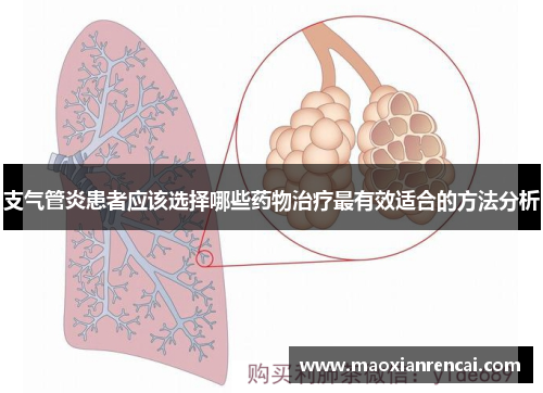 支气管炎患者应该选择哪些药物治疗最有效适合的方法分析