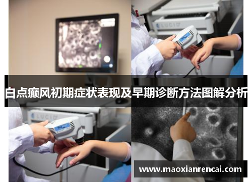 白点癫风初期症状表现及早期诊断方法图解分析